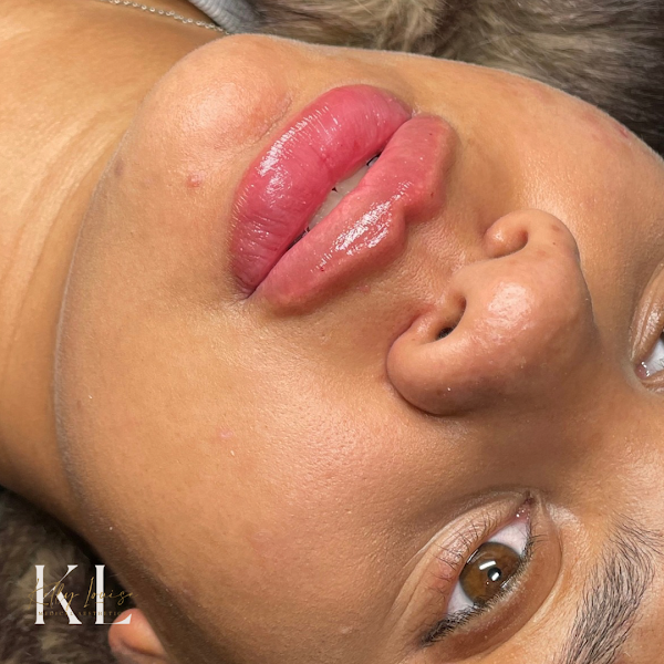 Kelly Louise Medical Aesthetics
